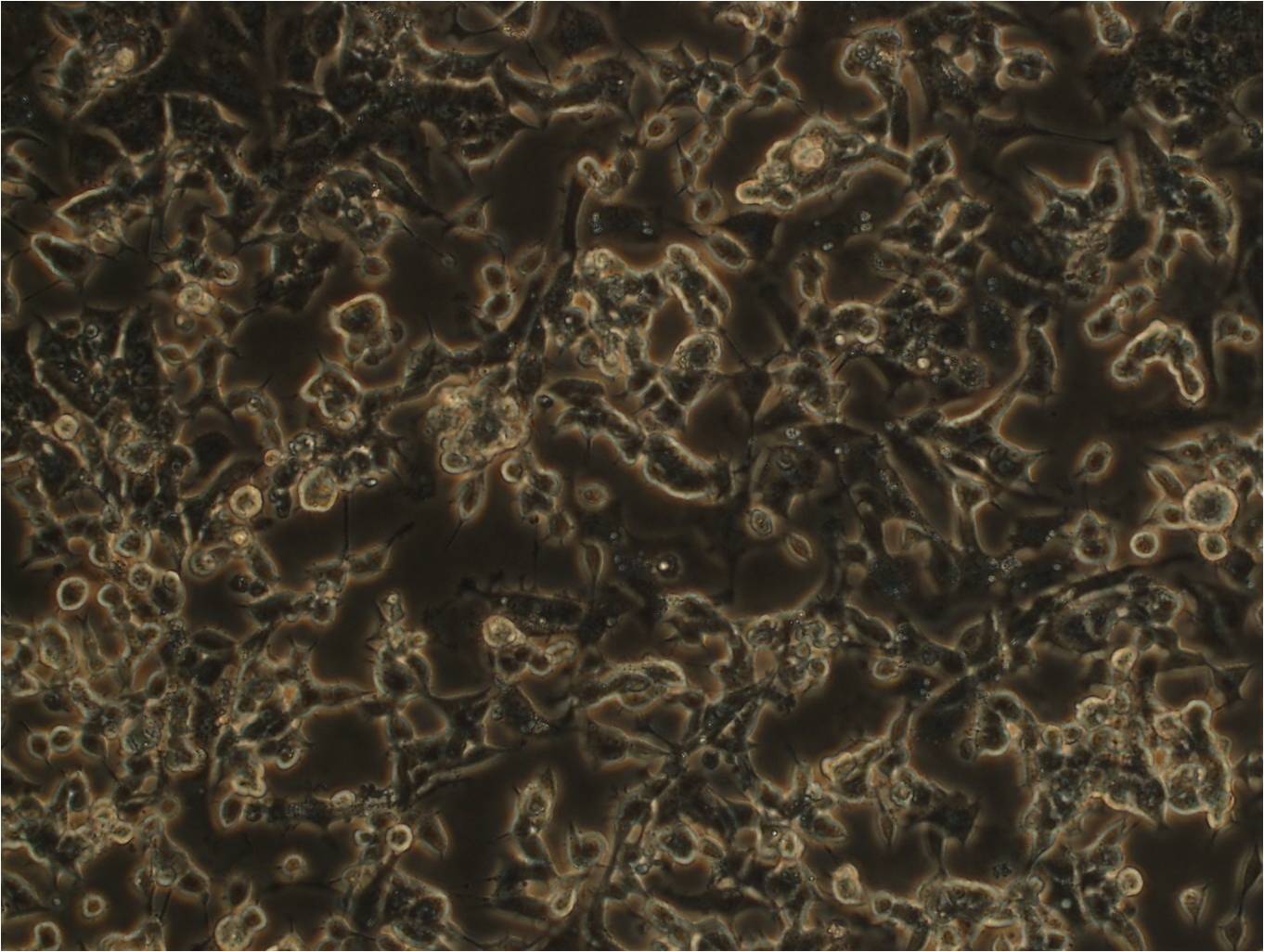 SK-MEL-2 Fresh Cells|人恶性黑色素瘤细胞(送STR基因图谱),SK-MEL-2 Fresh Cells