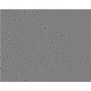 RL95-2 Fresh Cells|人子宫内膜癌细胞(送STR基因图谱)