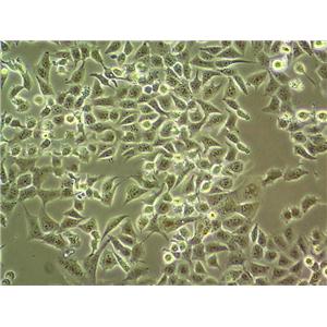 E-180 Fresh Cells|人子宫颈表皮癌细胞(送STR基因图谱)