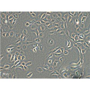 Sp2/0-Ag14 Fresh Cells|小鼠骨髓瘤细胞(送STR基因图谱),Sp2/0-Ag14 Fresh Cells