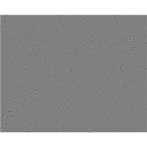 HuTu 80 Fresh Cells|人十二指肠腺癌细胞(送STR基因图谱)