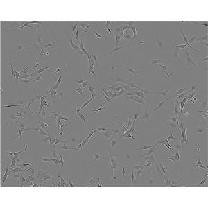 VA-ES-BJ Fresh Cells|人上皮样肉瘤细胞(送STR基因图谱)
