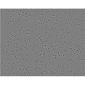 SK-NEP-1 Fresh Cells|人腎母細(xì)胞瘤細(xì)胞(送STR基因圖譜),SK-NEP-1 Fresh Cells