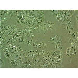 NCI-H1734 Fresh Cells|人非小细胞肺癌细胞(送STR基因图谱)