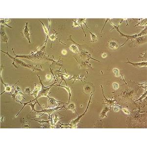 NCI-H1666 Fresh Cells|人肺支气管癌细胞(送STR基因图谱)