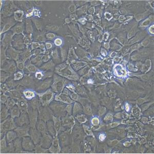 NCI-H727 Fresh Cells|人肺支氣管良性腫瘤細(xì)胞(送STR基因圖譜),NCI-H727 Fresh Cells