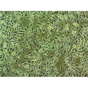 LK-2 Fresh Cells|人肺癌细胞(送STR基因图谱),LK-2 Fresh Cells