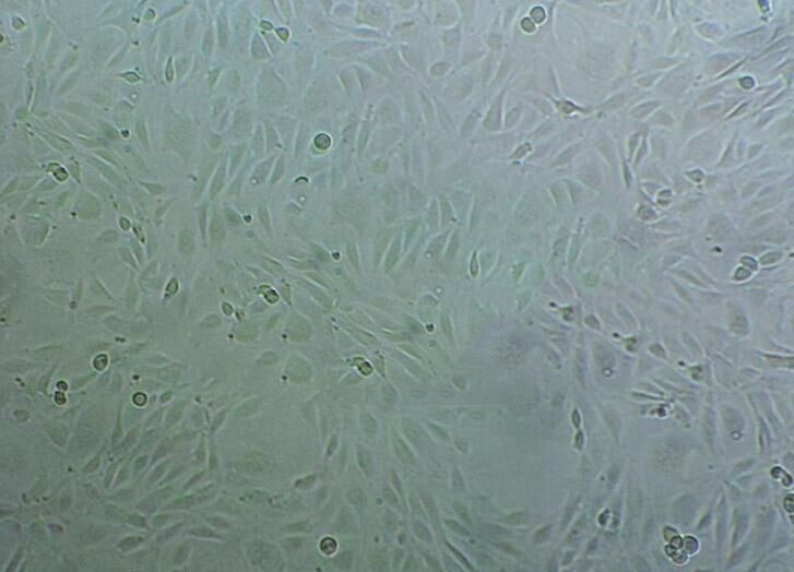 TE-10 Fresh Cells|人食管癌细胞(送STR基因图谱),TE-10 Fresh Cells