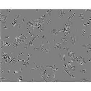 SK-MEL-3 Fresh Cells|人恶性黑色素瘤细胞(送STR基因图谱),SK-MEL-3 Fresh Cells