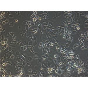 SK-MEL-31 Fresh Cells|人恶性黑色素瘤细胞(送STR基因图谱),SK-MEL-31 Fresh Cells