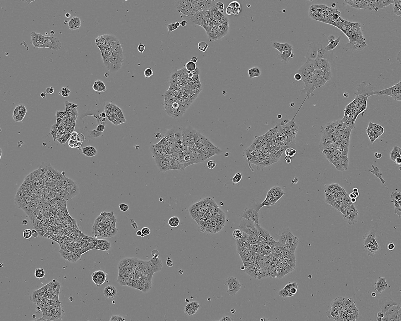 DMS 53 Fresh Cells|人小细胞肺癌细胞(送STR基因图谱),DMS 53 Fresh Cells