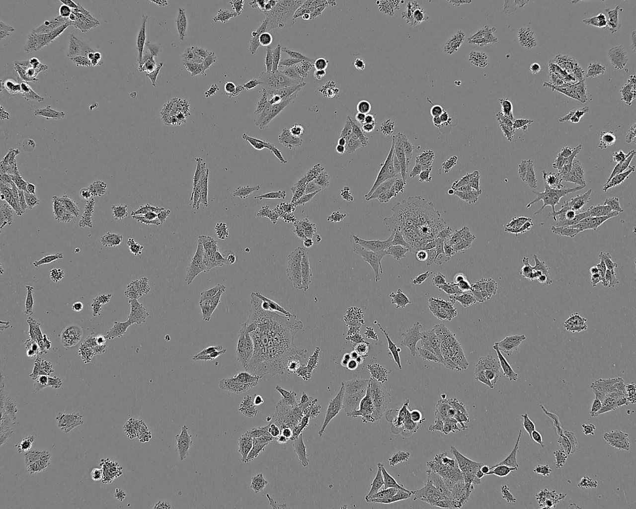 KYSE-30 Fresh Cells|人食道癌细胞(送STR基因图谱),KYSE-30 Fresh Cells