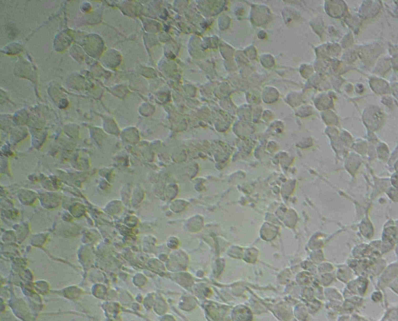 RLE-6TN Fresh Cells|大鼠肺泡Ⅱ型細胞(送STR基因圖譜),RLE-6TN Fresh Cells