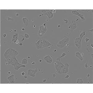 DMS 53 Fresh Cells|人小细胞肺癌细胞(送STR基因图谱)