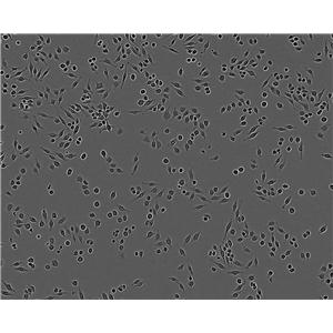 WISH Fresh Cells|人羊膜细胞(送STR基因图谱)