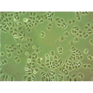 GP5d Fresh Cells|人结肠腺癌细胞(送STR基因图谱)