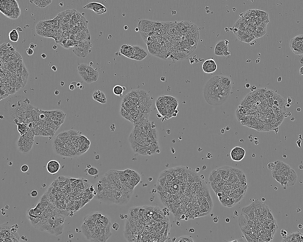 IOSE-29 Fresh Cells|人卵巢上皮细胞(送STR基因图谱),IOSE-29 Fresh Cells