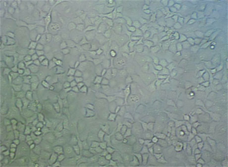 MDA-MB-435 Fresh Cells|人乳腺癌细胞(送STR基因图谱),MDA-MB-435 Fresh Cells