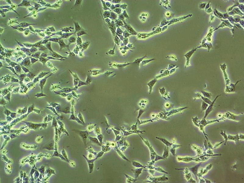 LTEP-sm Fresh Cells|人小细胞肺癌细胞(送STR基因图谱),LTEP-sm Fresh Cells