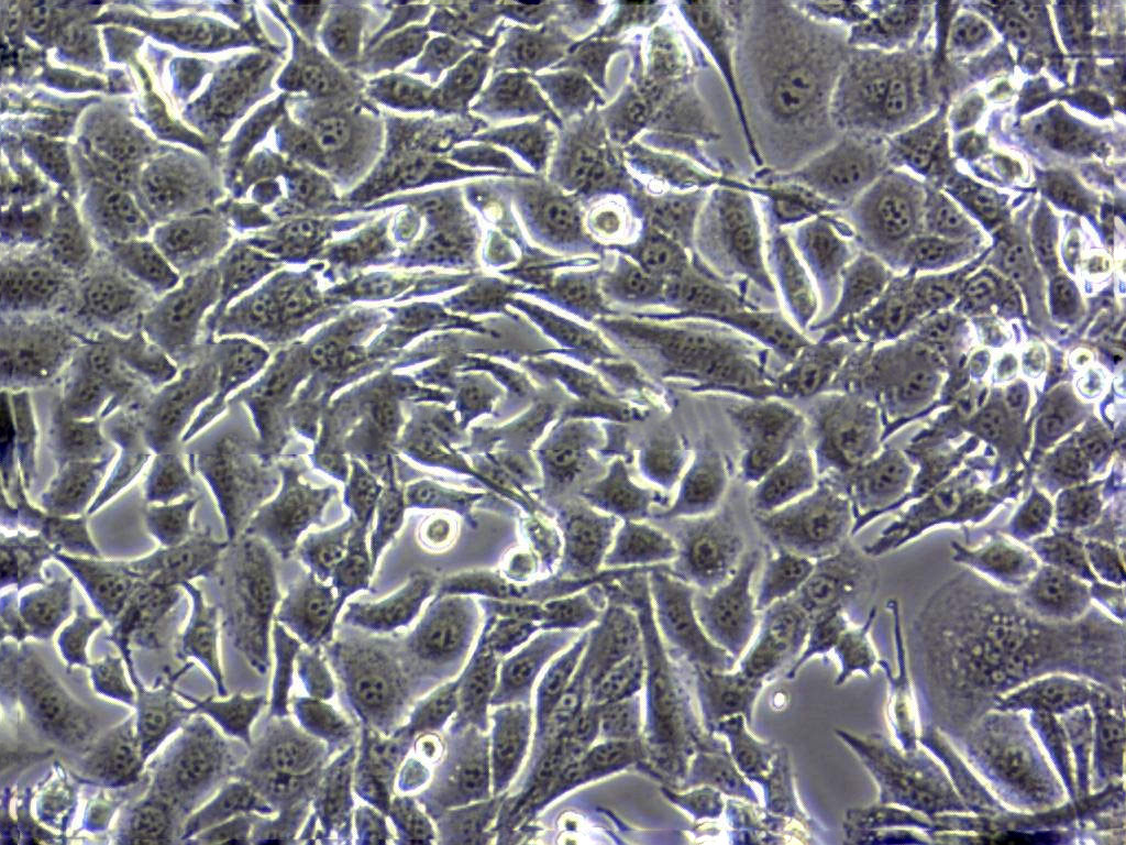 OVSAHO Fresh Cells|人卵巢癌细胞(送STR基因图谱),OVSAHO Fresh Cells