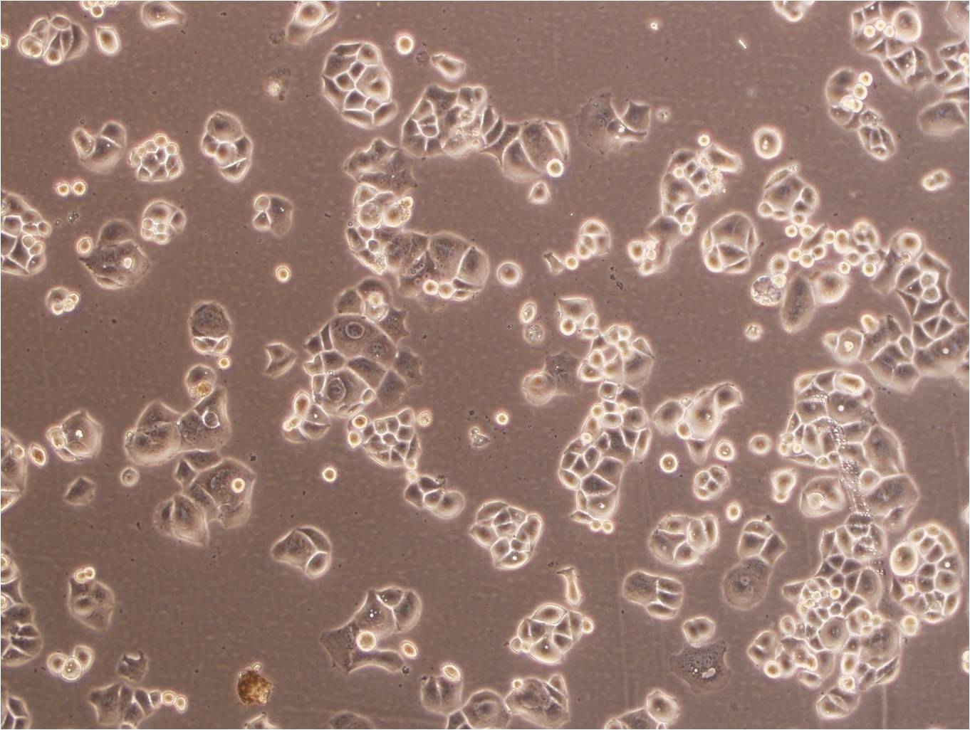 SNU-119 Fresh Cells|人卵巢癌细胞(送STR基因图谱),SNU-119 Fresh Cells