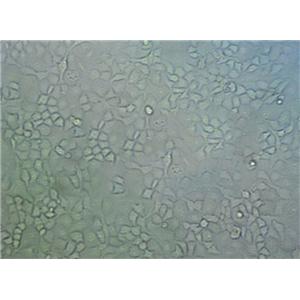 MDA-MB-435 Fresh Cells|人乳腺癌细胞(送STR基因图谱),MDA-MB-435 Fresh Cells