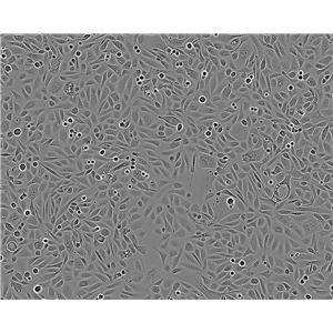 Kelly Fresh Cells|人神经母细胞瘤细胞(送STR基因图谱)