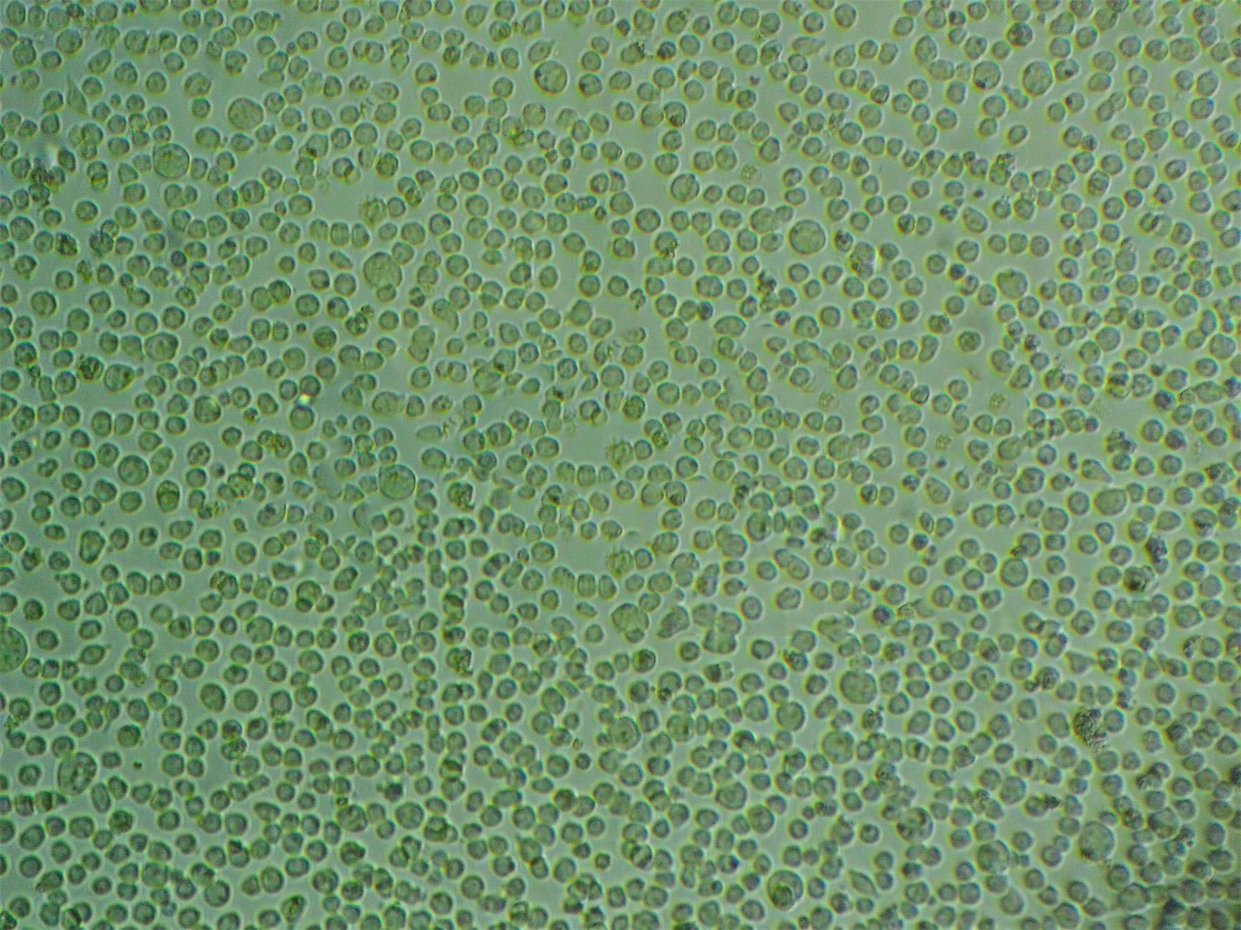 HSC-5 [Human skin squamous cell carcinoma] Cells|人皮膚鱗癌克隆細(xì)胞(包送STR鑒定報(bào)告),HSC-5 [Human skin squamous cell carcinoma] Cells