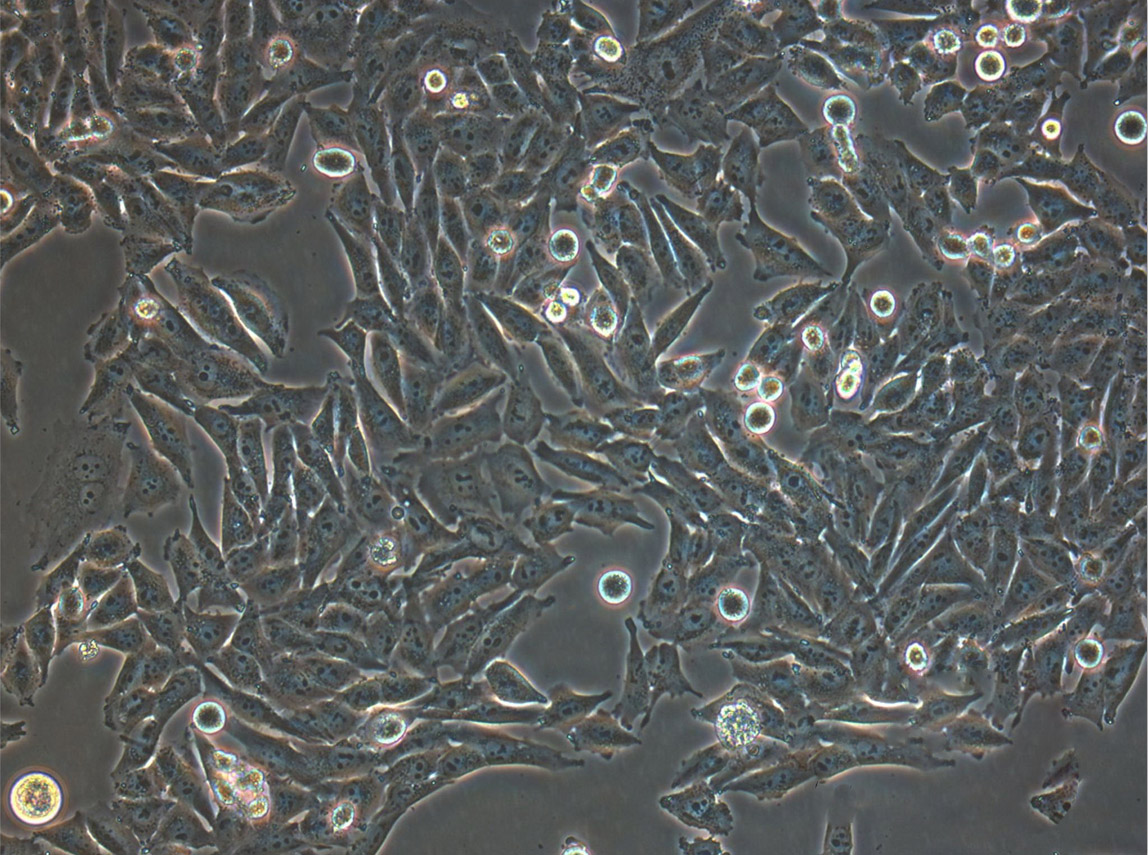 SK-N-AS Cells|人脑神经母细胞瘤克隆细胞(包送STR鉴定报告),SK-N-AS Cells