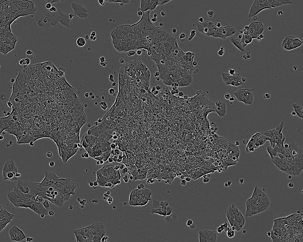 HOS Cells|人骨肉瘤克隆细胞(包送STR鉴定报告),HOS Cells