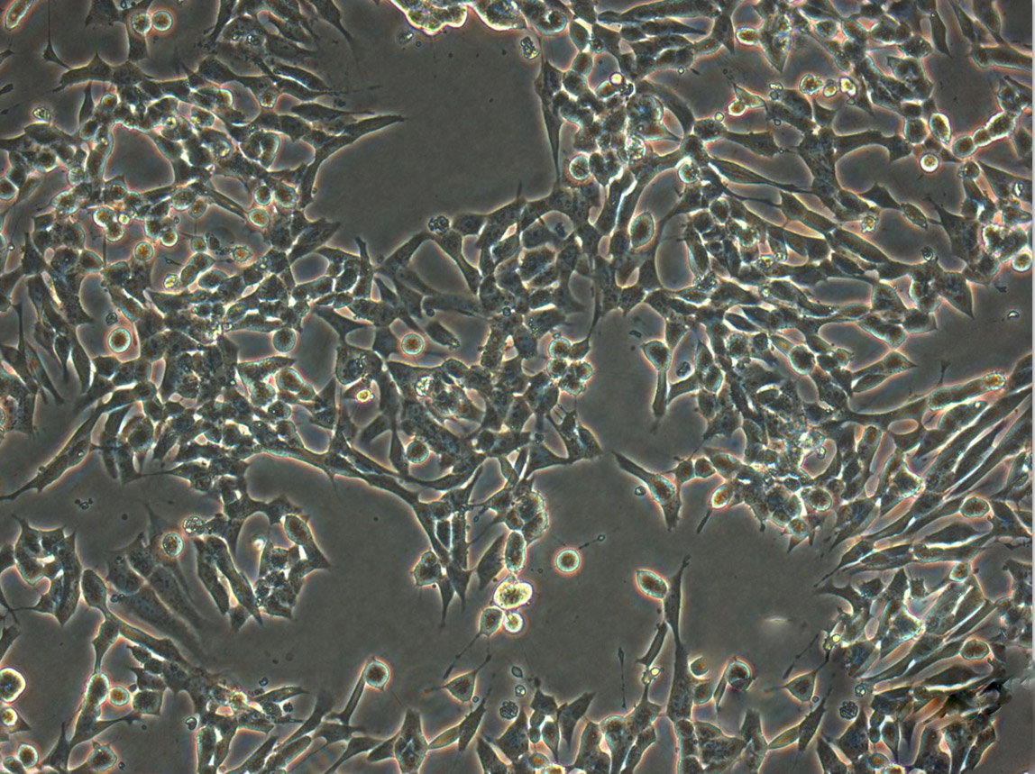 AN3-CA Cells|人子宫内膜腺癌克隆细胞(包送STR鉴定报告),AN3-CA Cells