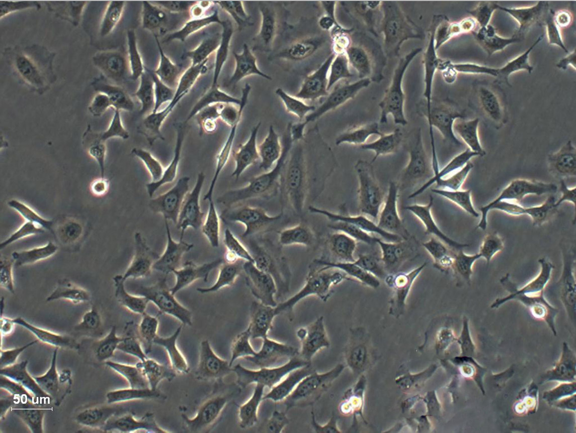 MV3:人黑色素瘤复苏细胞(提供STR鉴定图谱),MV3