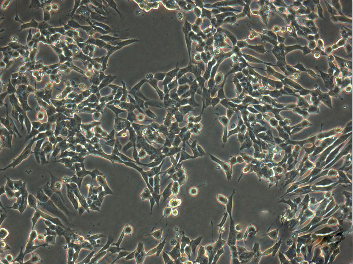 PC-3M-2B4:人低转移前列腺癌复苏细胞(提供STR鉴定图谱),PC-3M-2B4