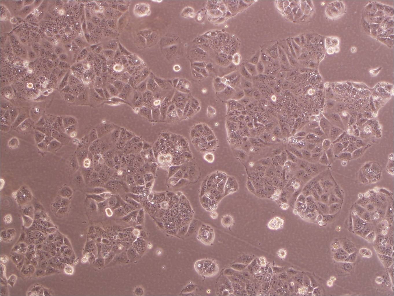 Mahlavu:人肝癌复苏细胞(提供STR鉴定图谱),Mahlavu