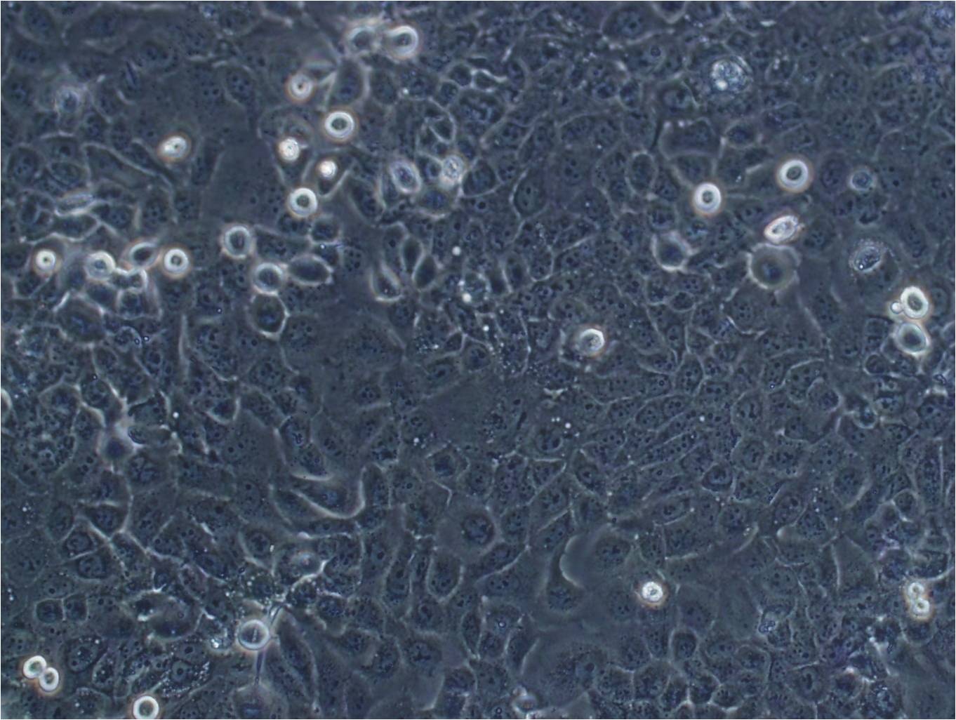 U-138MG:人脑神经胶质瘤复苏细胞(提供STR鉴定图谱),U-138MG