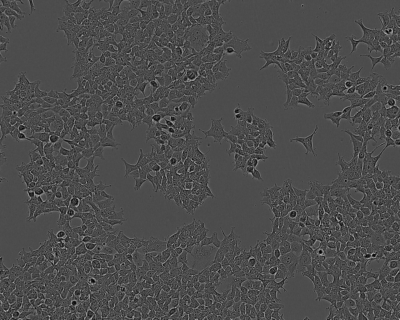 BNL 1ME A.7R.1:小鼠肝上皮复苏细胞(提供STR鉴定图谱),BNL 1ME A.7R.1