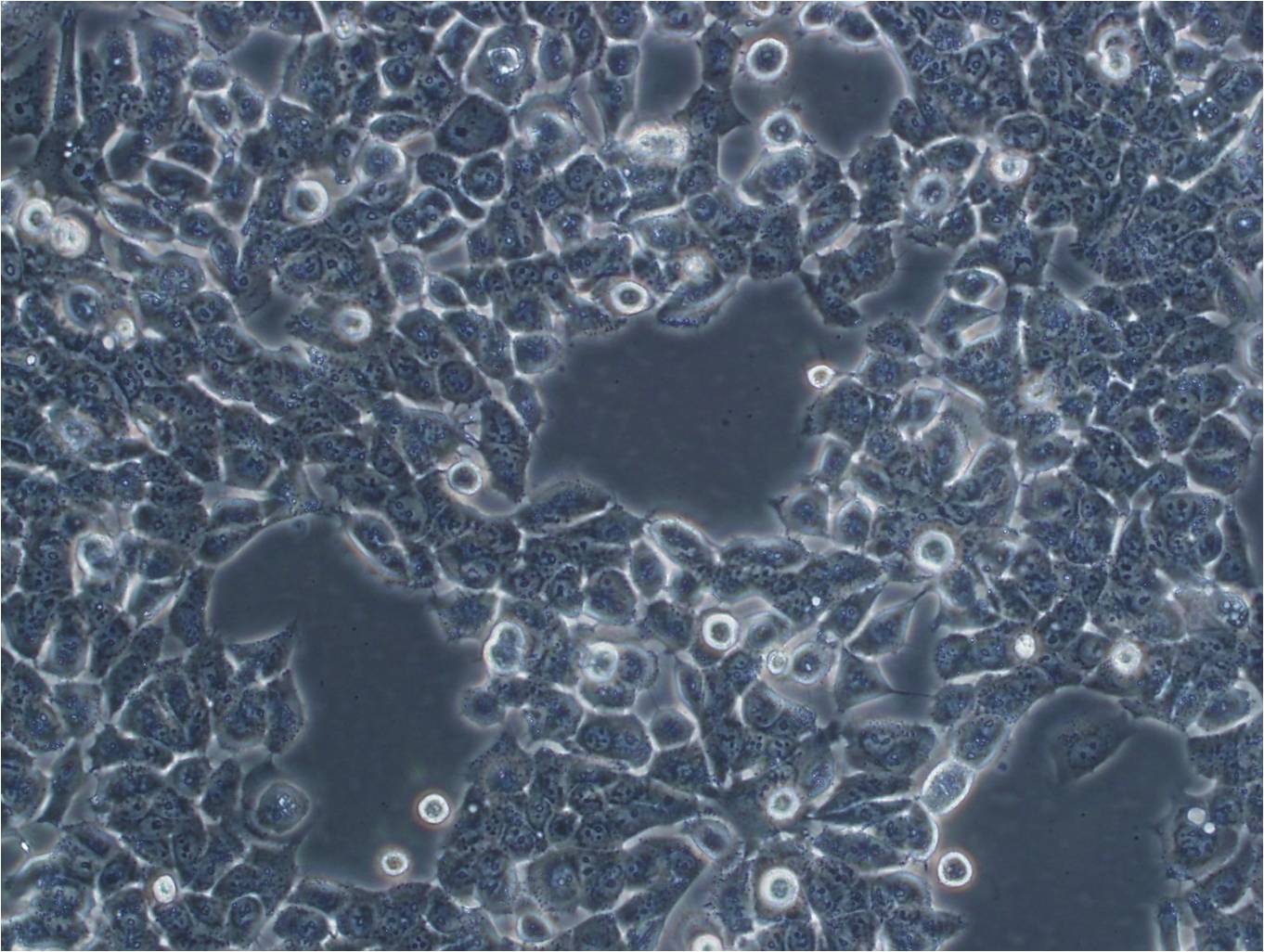OVCAR-5 Cells|人卵巢癌克隆细胞(包送STR鉴定报告),OVCAR-5 Cells