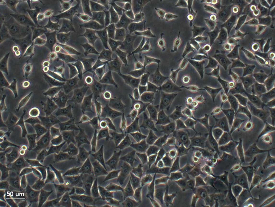 SV40 MES 13:小鼠肾小球系膜复苏细胞(提供STR鉴定图谱),SV40 MES 13