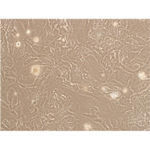 N1E-115 Cells|小鼠神经母细胞瘤克隆细胞(包送STR鉴定报告)