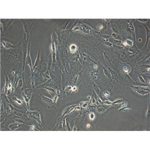 NTERA-2:人恶性多发性畸胎瘤复苏细胞(提供STR鉴定图谱)