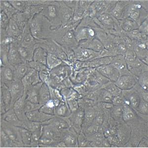 NCI-H719 Cells|人小细胞肺癌克隆细胞(包送STR鉴定报告)