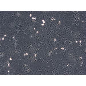 HCCC-9810 Cells|人胆管细胞型肝癌克隆细胞(包送STR鉴定报告),HCCC-9810 Cells