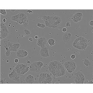Nthy-ori 3-1:人甲状腺正常复苏细胞(提供STR鉴定图谱)