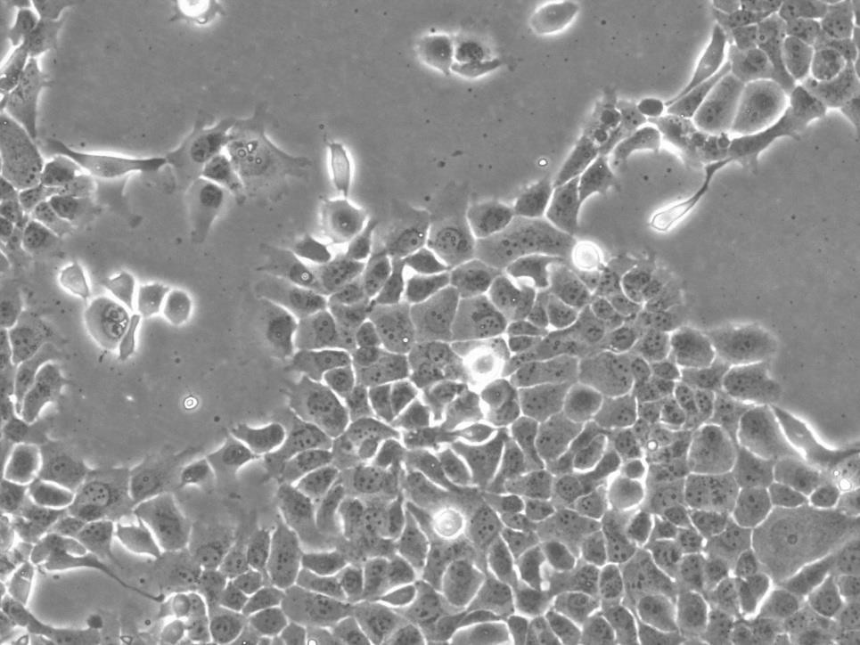 RLE-6TN:大鼠肺泡Ⅱ型复苏细胞(提供STR鉴定图谱),RLE-6TN