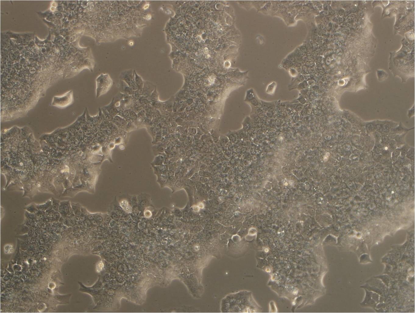 ID8:小鼠卵巢癌复苏细胞(提供STR鉴定图谱),ID8