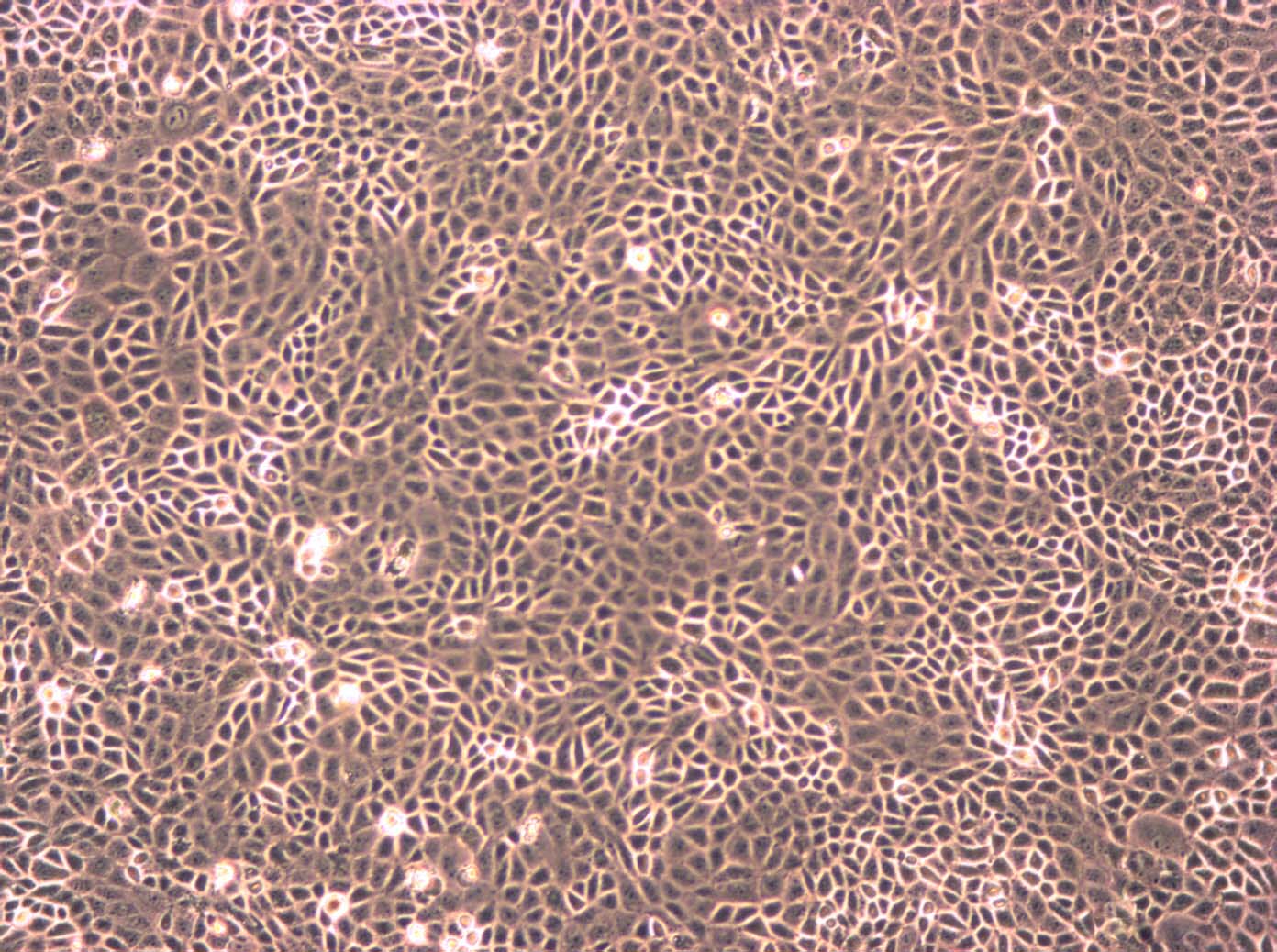 TE-6:人食管癌复苏细胞(提供STR鉴定图谱),TE-6