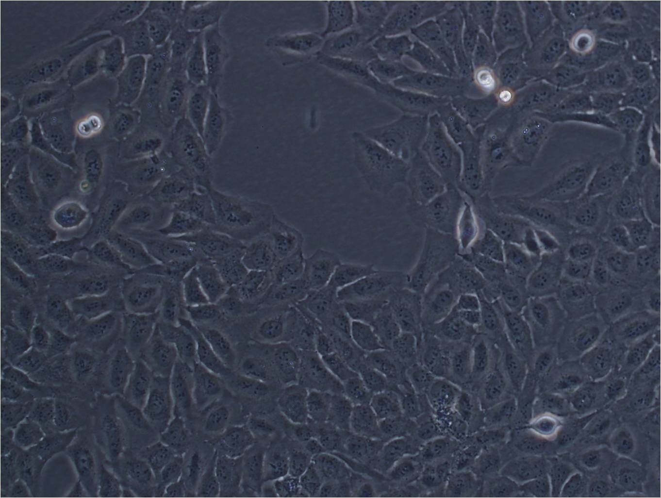 TE-4:人食管癌复苏细胞(提供STR鉴定图谱),TE-4