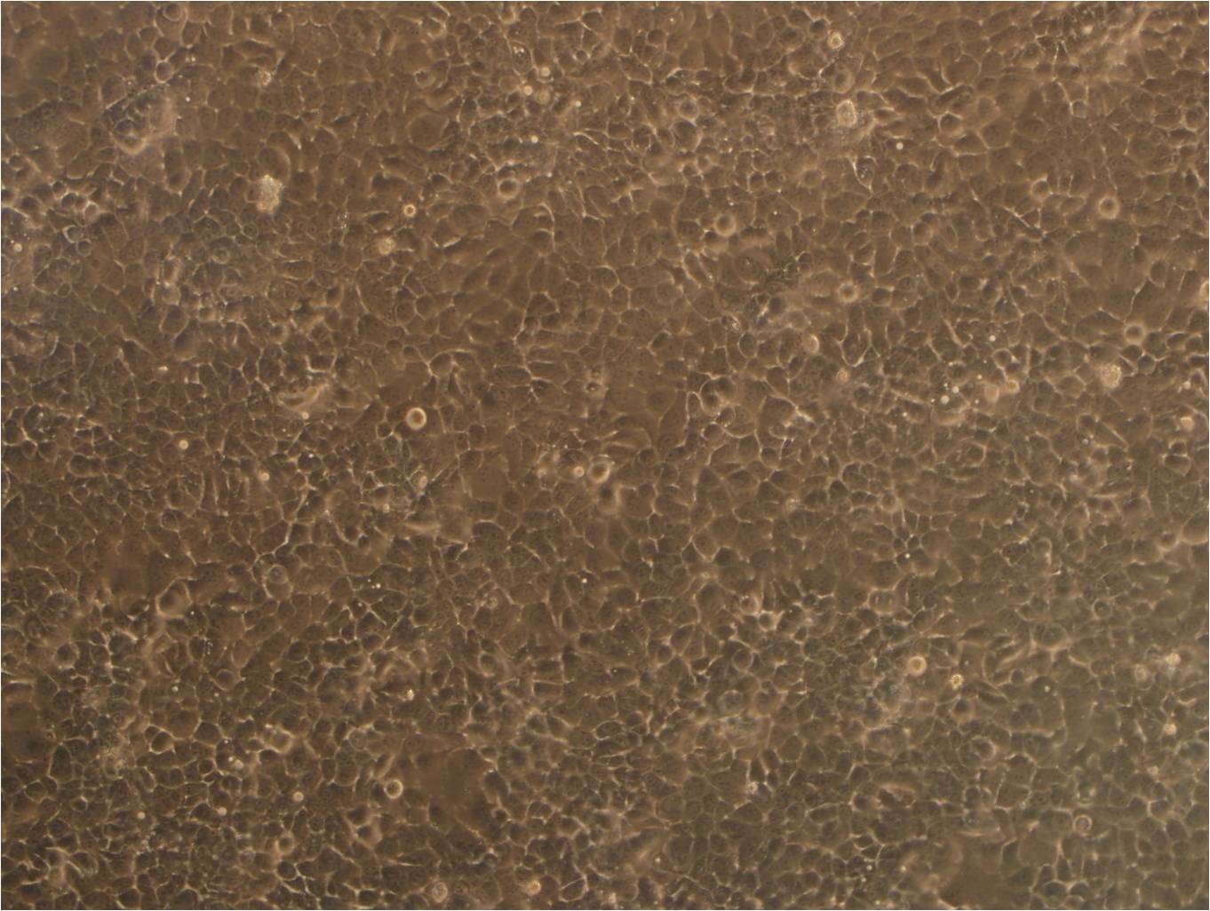 SNU-1:人胃癌复苏细胞(提供STR鉴定图谱),SNU-1