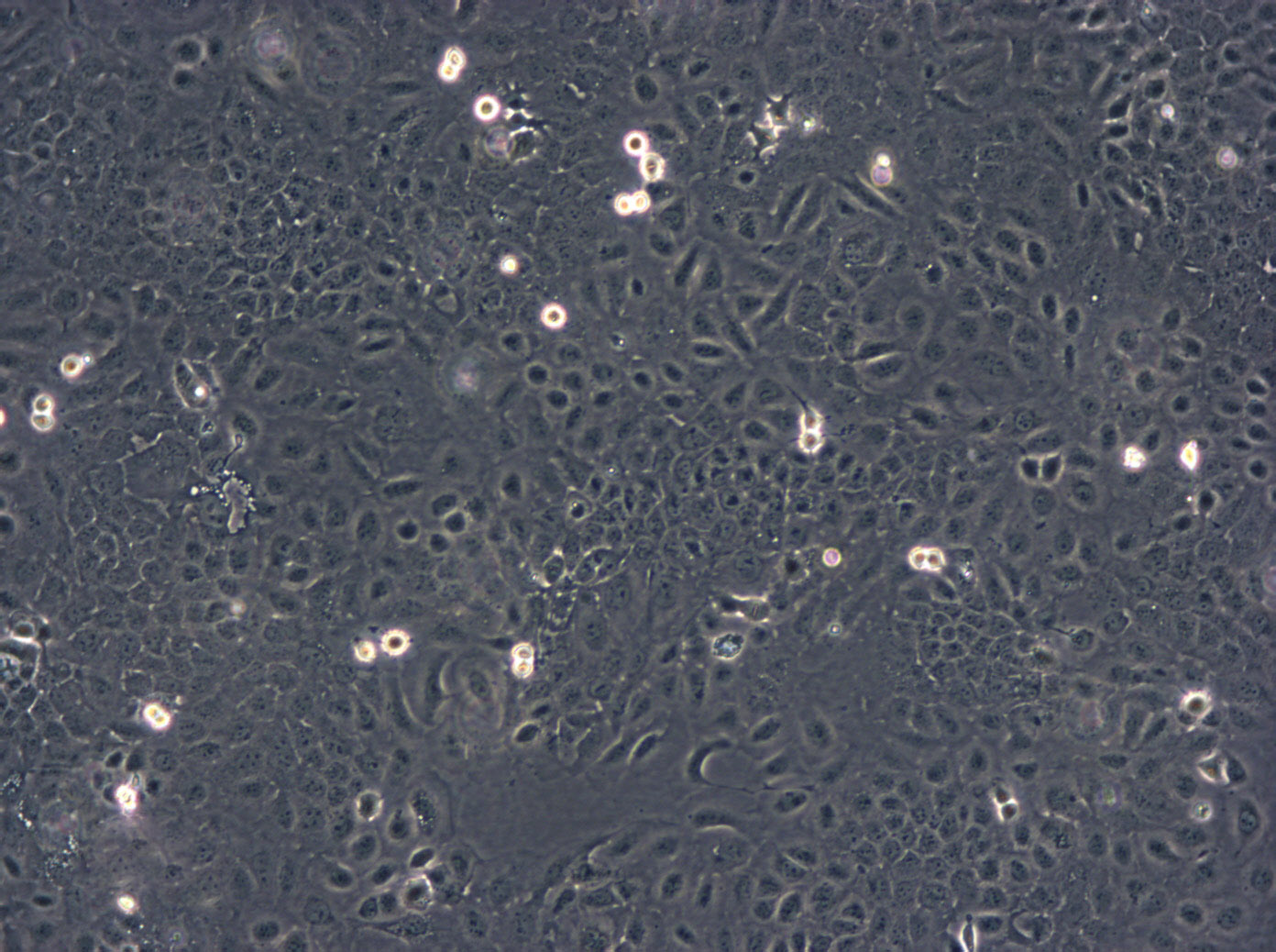 Capan-2:人胰腺癌复苏细胞(提供STR鉴定图谱),Capan-2