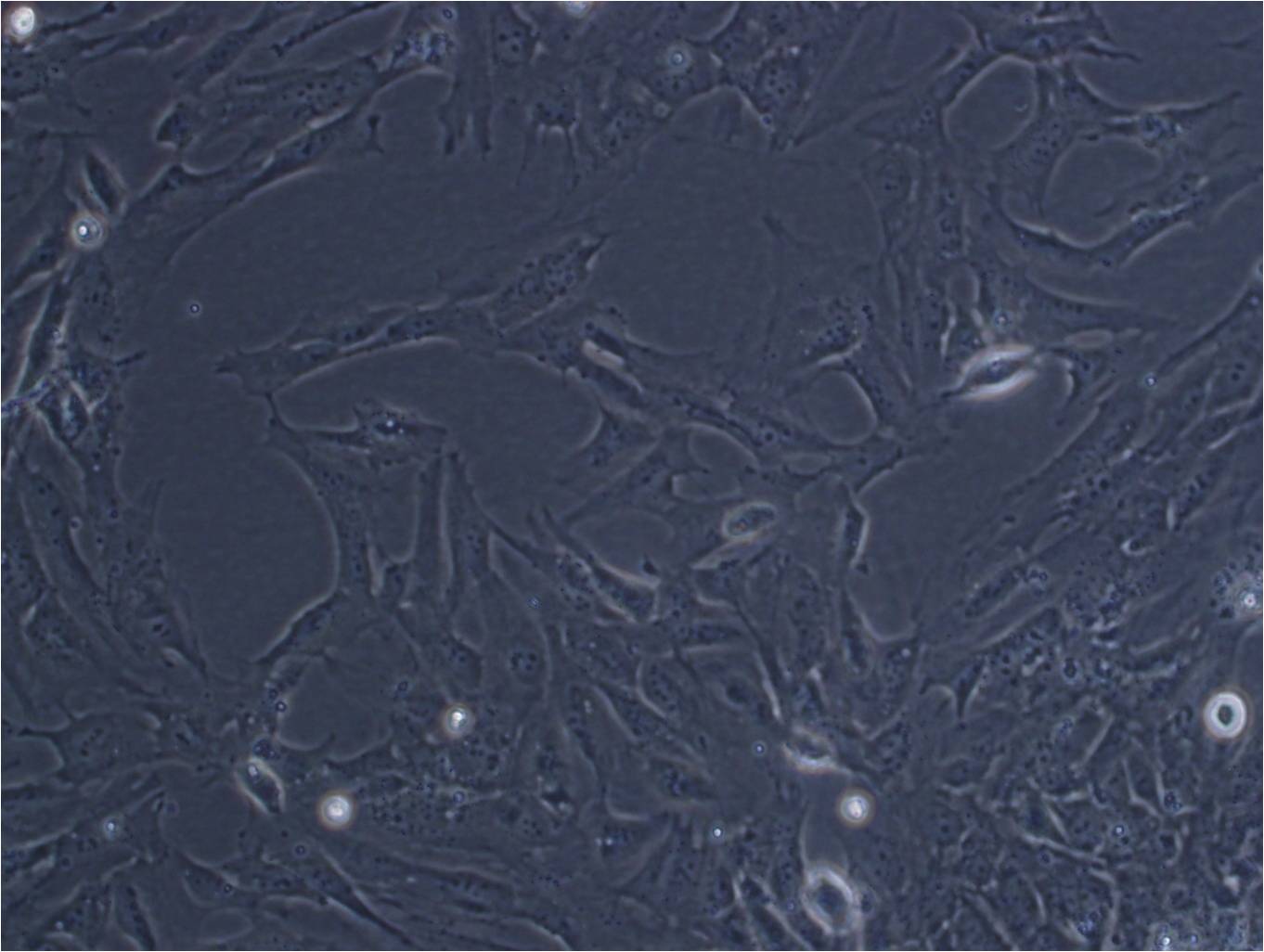 TOV-112D:人上皮性卵巢癌复苏细胞(提供STR鉴定图谱),TOV-112D